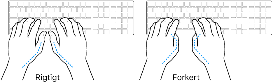 Hænder anbragt over et tastatur med rigtig og forkert position af tommelfingre.