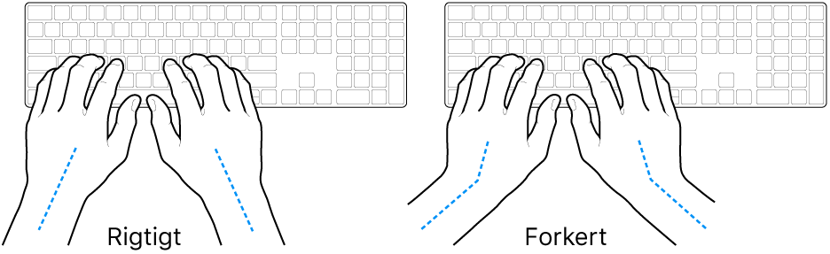 Hænder anbragt over et tastatur med rigtig og forkert position af håndled og hånd.