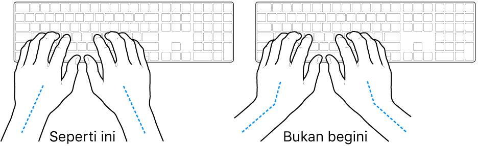 Tangan diposisikan di atas papan ketik, menampilkan penyejajaran pergelangan tangan dan tangan yang benar dan salah.