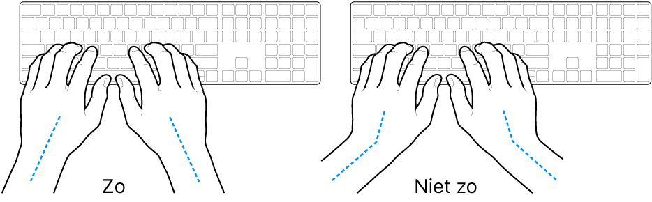 Handen boven een toetsenbord, waarbij de goede en verkeerde stand van de handen en polsen wordt aangegeven.
