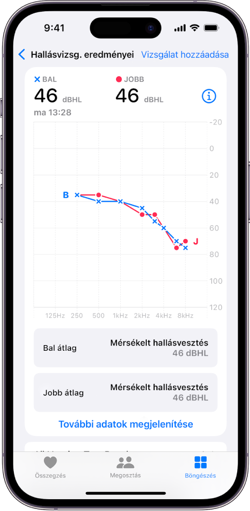 Audiogram egy iPhone-on, amely jelzi, hogy mindkét fül esetében mérsékelt szintű halláskárosodás észlelhető.