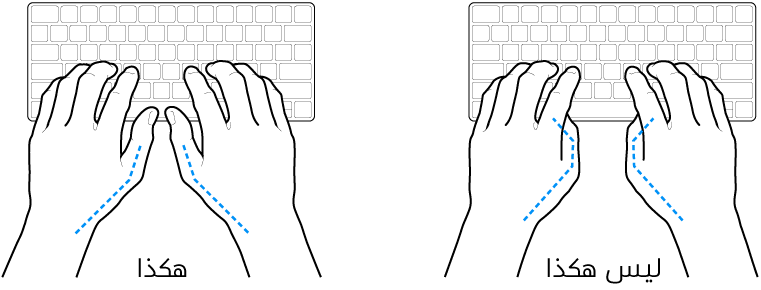 يدان موضوعتان على لوحة مفاتيح، ويظهر الوضع الصحيح وغير الصحيح للإبهامين.