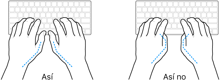 Manos colocadas sobre un teclado que muestran una posición correcta e incorrecta de los pulgares.