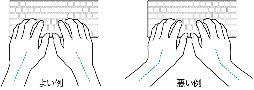 キーボードに置かれた手。手首と手の適切な位置関係と不適切な位置関係を示しています。