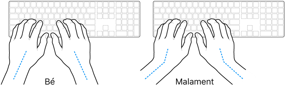 Unes mans posades sobre un teclat mostrant l’alineació correcta i incorrecta del canell i la mà.