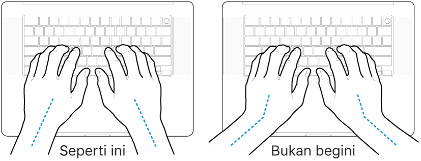 Tangan diposisikan di atas papan ketik, menampilkan penyejajaran pergelangan tangan dan tangan yang benar dan salah.
