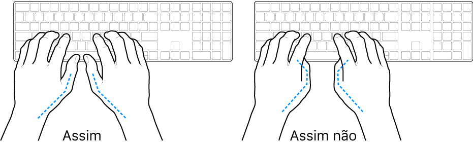 As mãos posicionadas sobre um teclado a mostrar a colocação correta e incorreta dos polegares.