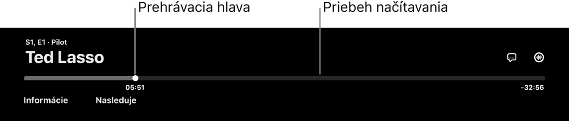 Ovládacie prvky prehrávania