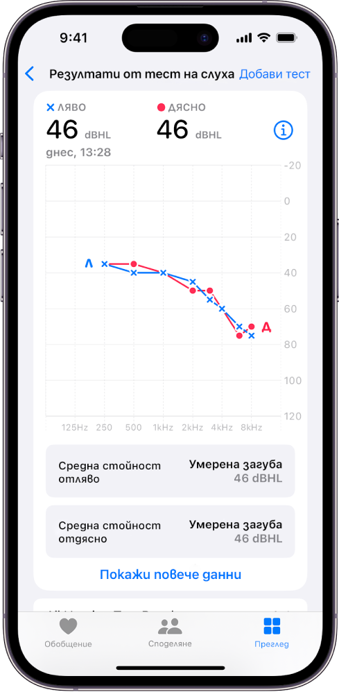 Аудиограма на iPhone, която показва средна загуба на слуха в двете уши.