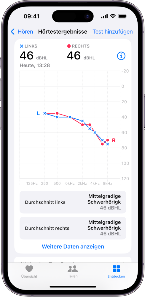 Ein Audiogramm auf dem iPhone zeigt mittelgradige Schwerhörigkeit auf beiden Ohren an.