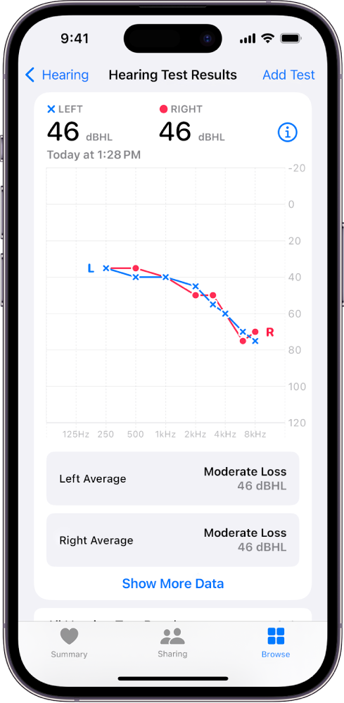 iPhone’is kuvatav audiogramm, mis näitab mõõdukat kuulmiskadu mõlemas kõrvas.