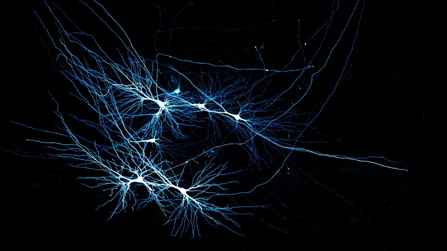 Several nerve cells on a black background. The cell bodies are white, and each has dozens of blue branches sprouting outward.