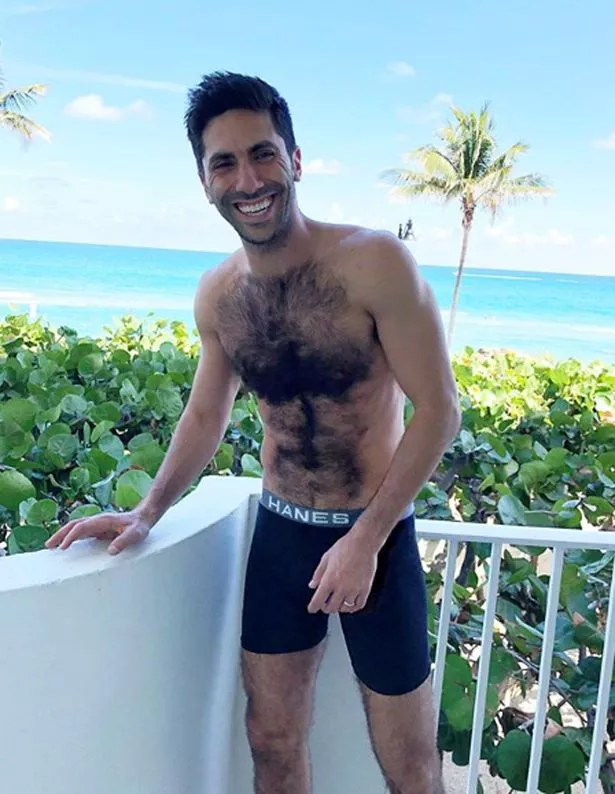 Catfish host Nev Schulman has revealed he broke his neck in a horror accident