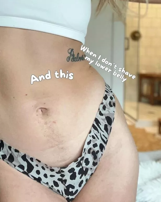 Mik Zazon flaunted her natural body to show she isn't "perfect"