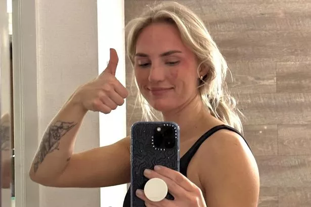 Mik Zazon flaunted her natural body to show she isn't "perfect"