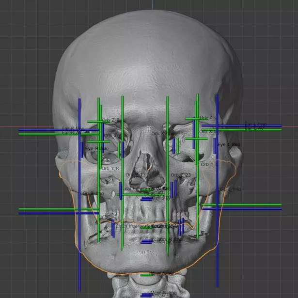 The real Santa's skull