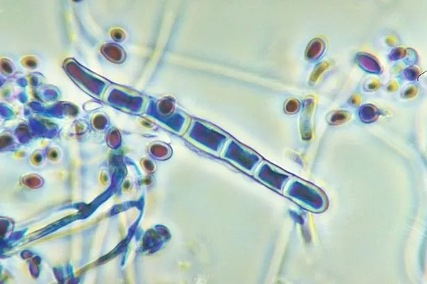 Micrograph of the fungus Trichophyton rubrum 