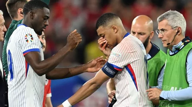 Kylian Mbappe of France leaves the field whilst holding his face,