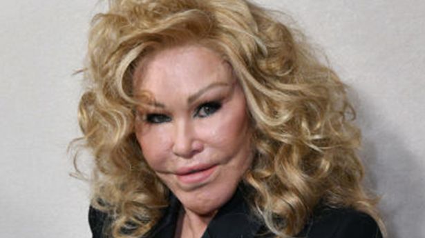 Jocelyn Wildenstein