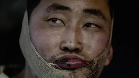 The image shows a close-up of mans face. He has a bloodied lip and bandage around his jaw and he is looking away from the camera 