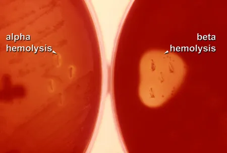 Image of beta hemolysis.