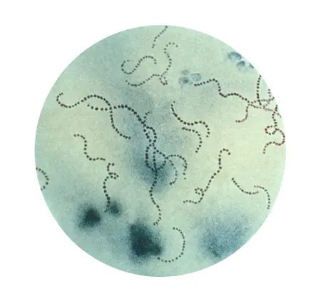 Streptococcus pyogenes (GAS)