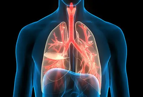 The flares depend on the patient's lung function and immune response.