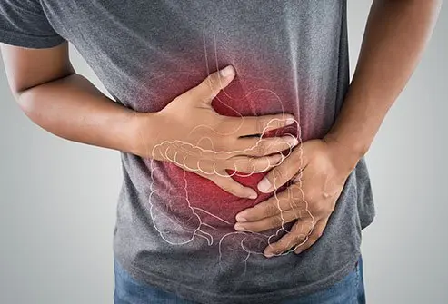 Crohn's disease is a chronic inflammatory bowel disease that causes symptoms such as abdominal pain.