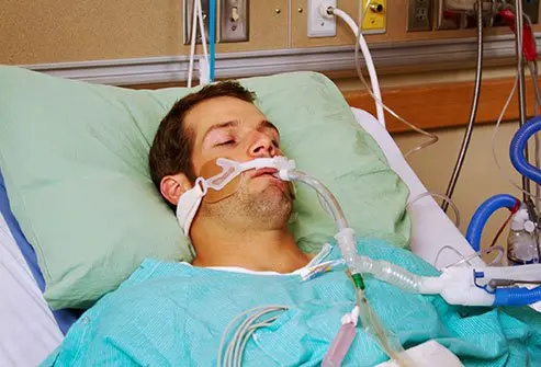 Mechanical ventilation or breathing machines are part of doctors' arsenal to treat COVID-19 coronavirus disease in patients with the worst lung symptoms.