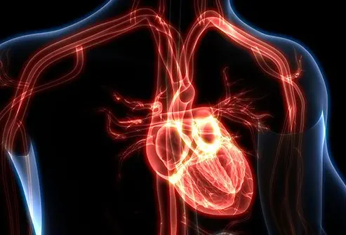 Dilated Cardiomyopathy