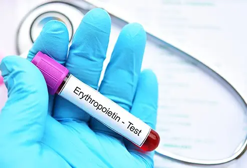 Erythropoietin (EPO) Test