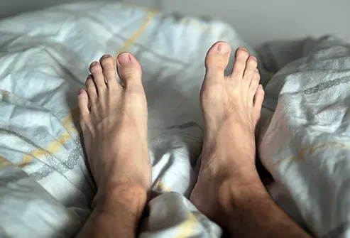 restless legs syndrome