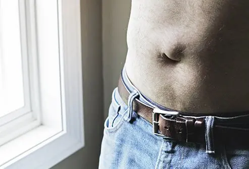 An umbilical hernia in adults can produce a bulging belly button.