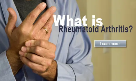 What is Rheumatoid Arthritis?