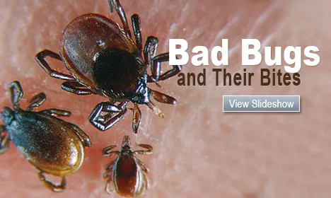 Bad Bugs and Their Bites