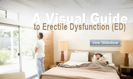  A Visual Guide to Erectile Dysfunction (ED)