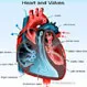 Aortic Stenosis