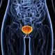 Bladder Infection (Cystitis)