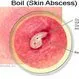 Picture of Boil