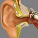 What Is Middle Ear Surgery?