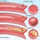 Picture of Cholesterol