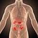 Is Crohn's Disease Contagious?