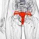 How Serious Is Endometrial Cancer?