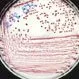 Enterovirulent E. coli (EEC)