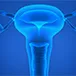 How Common Is Primary Ovarian Insufficiency?