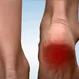 What Is the Fastest Way To Cure Heel Pain?