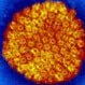 Picture of Herpes Simplex Virus Type 2