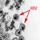 Picture of HIV/AIDS