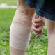 Can DVT Cause Acute Limb Ischemia?