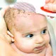 Is It OK to Pick and Scratch Cradle Cap Off?